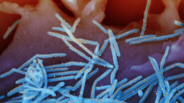 RSV virus 